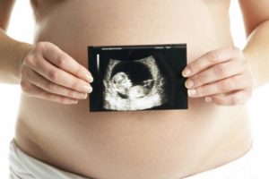 sintomas embarazo anembrionario