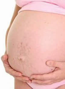 varicela embarazo tercer trimestre